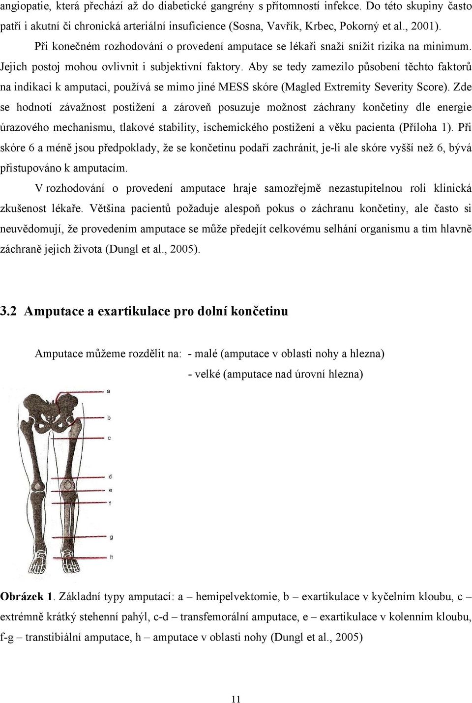 Aby se tedy zamezilo působení těchto faktorů na indikaci k amputaci, používá se mimo jiné MESS skóre (Magled Extremity Severity Score).