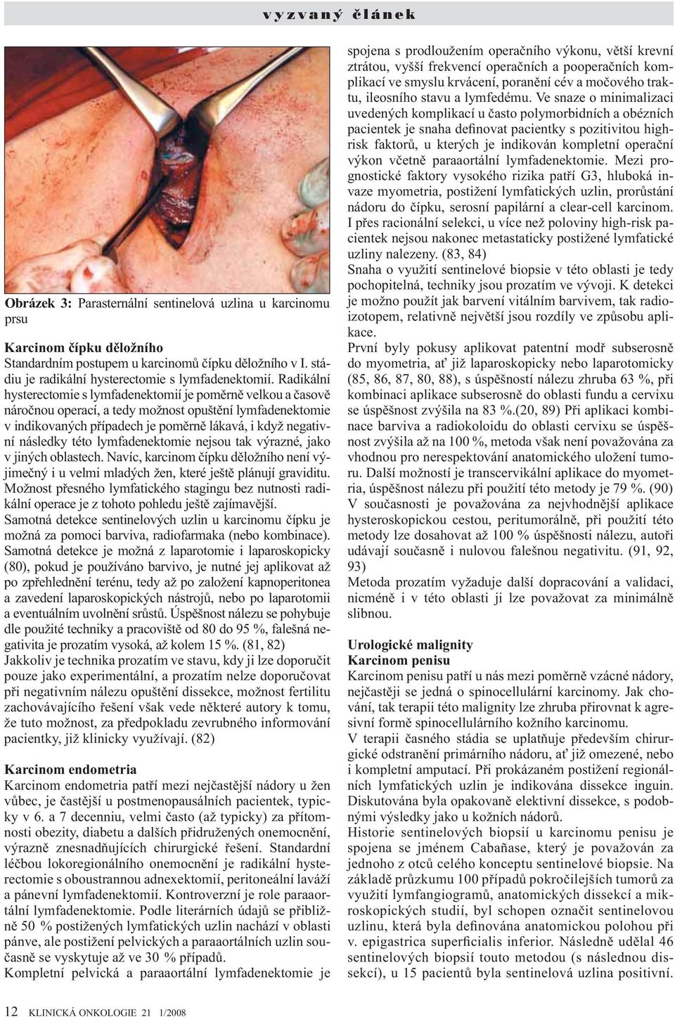 Radikální hysterectomie s lymfadenektomií je poměrně velkou a časově náročnou operací, a tedy možnost opuštění lymfadenektomie v indikovaných případech je poměrně lákavá, i když negativní následky