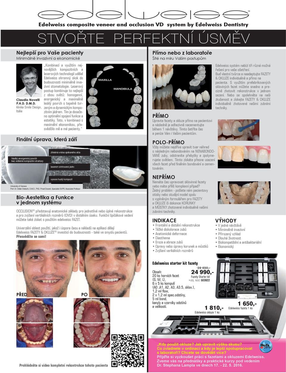 ntistry STVOŘTE PERFEKTNÍ ÚSMĚV Nejlepší pro Vaše pacienty Minimálně invazivní a ekonomické Claudio Novelli P.H.D.