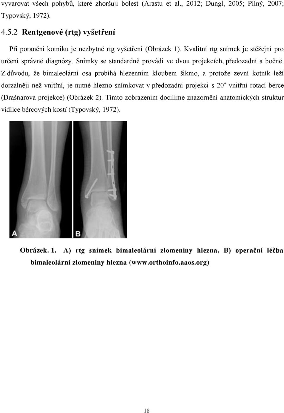 Z důvodu, že bimaleolární osa probíhá hlezenním kloubem šikmo, a protože zevní kotník leží dorzálněji než vnitřní, je nutné hlezno snímkovat v předozadní projekci s 20 vnitřní rotací bérce