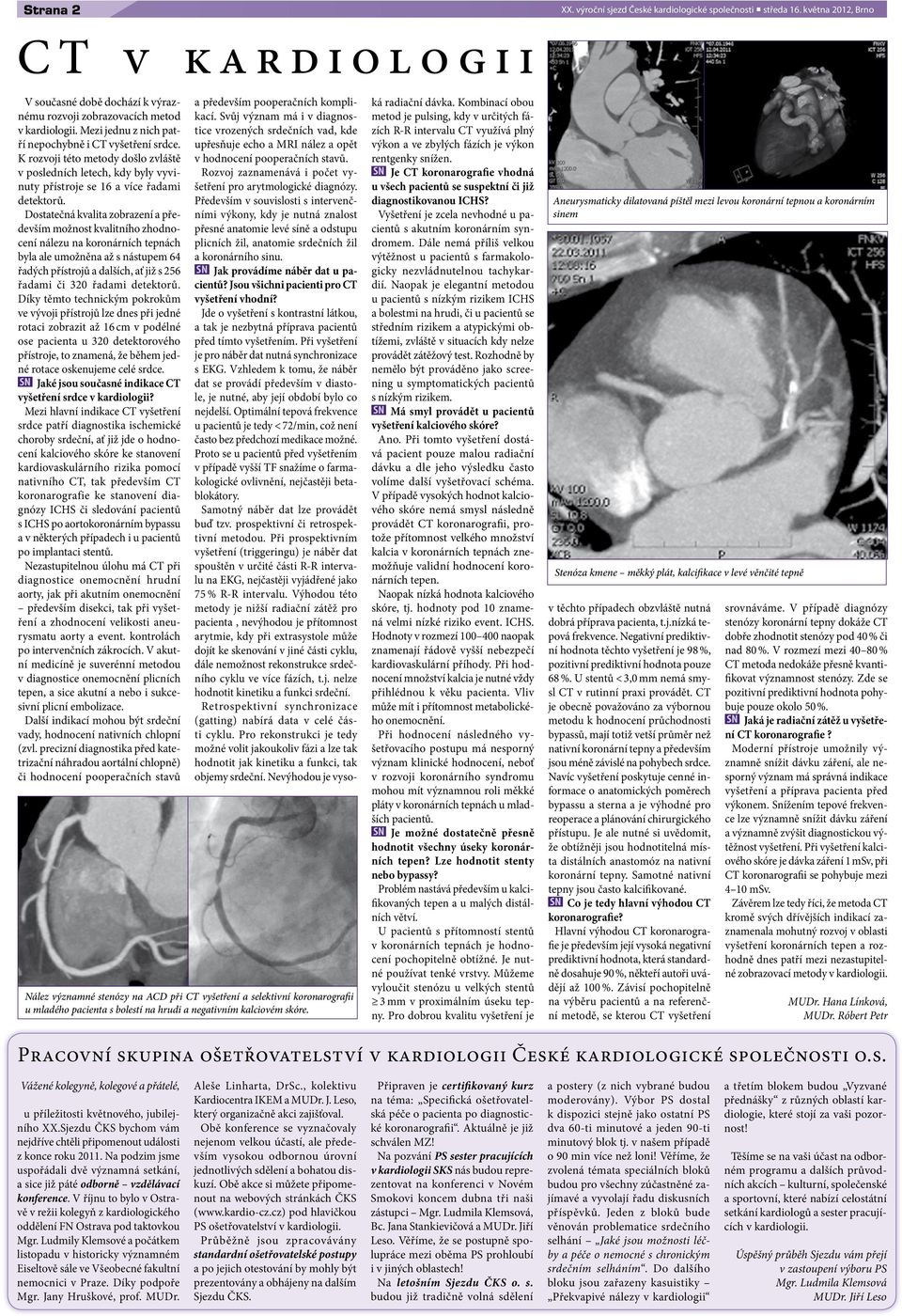 Dosttečná kvlit zobrzení především možnost kvlitního zhodnocení nálezu n koronárních tepnách byl le umožněn ž s nástupem 64 řdých přístrojů dlších, ť již s 256 řdmi či 320 řdmi detektorů.