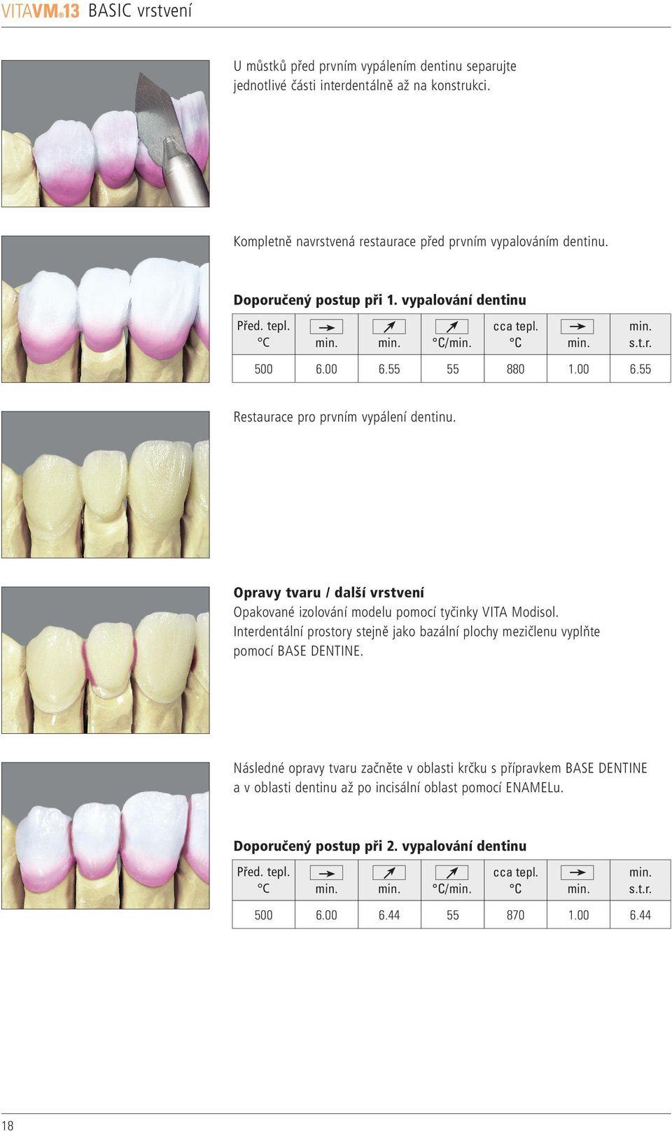 Opravy tvaru / další vrstvení Opakované izolování modelu pomocí tyčinky VITA Modisol. Interdentální prostory stejně jako bazální plochy mezičlenu vyplňte pomocí BASE DENTINE.