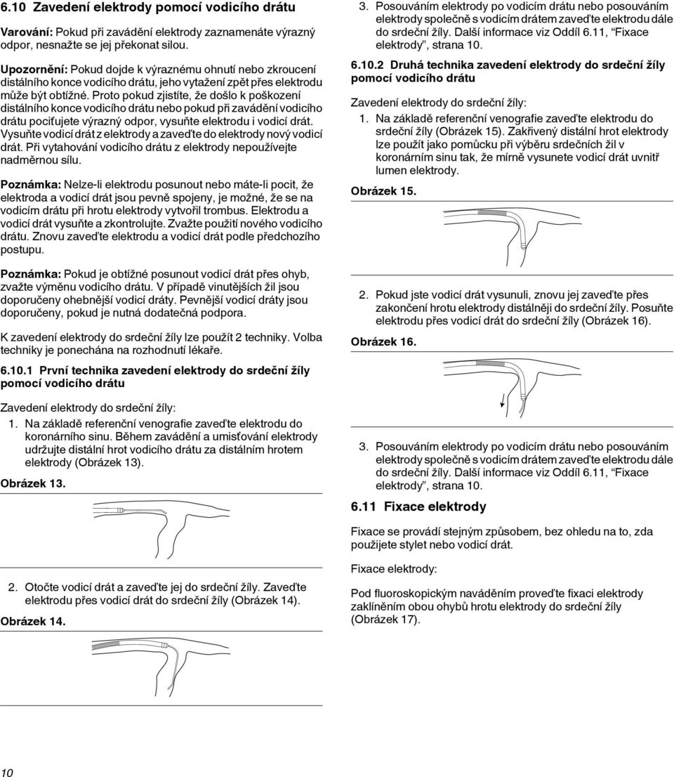 Proto pokud zjistíte, že došlo k poškození distálního konce vodicího drátu nebo pokud při zavádění vodicího drátu pociťujete výrazný odpor, vysuňte elektrodu i vodicí drát.