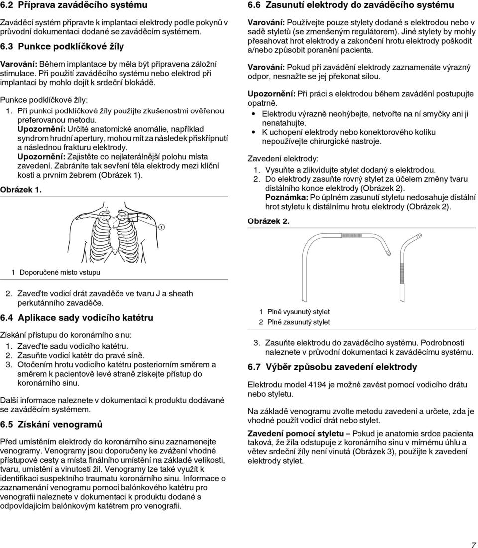 Punkce podklíčkové žíly: 1. Při punkci podklíčkové žíly použijte zkušenostmi ověřenou preferovanou metodu.