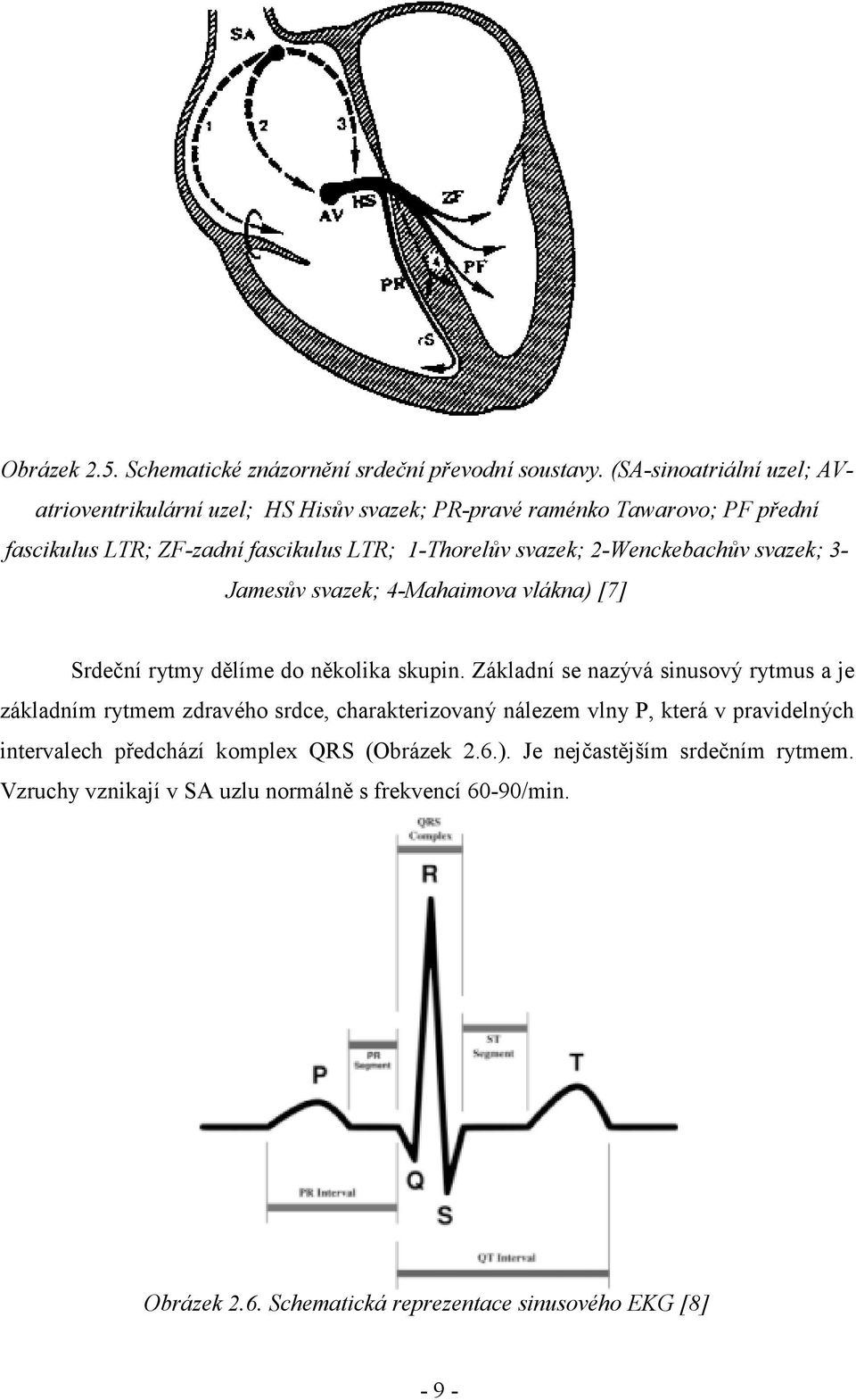 2-Wenckebachův svazek; 3- Jamesův svazek; 4-Mahaimova vlákna) [7] Srdeční rytmy dělíme do několika skupin.