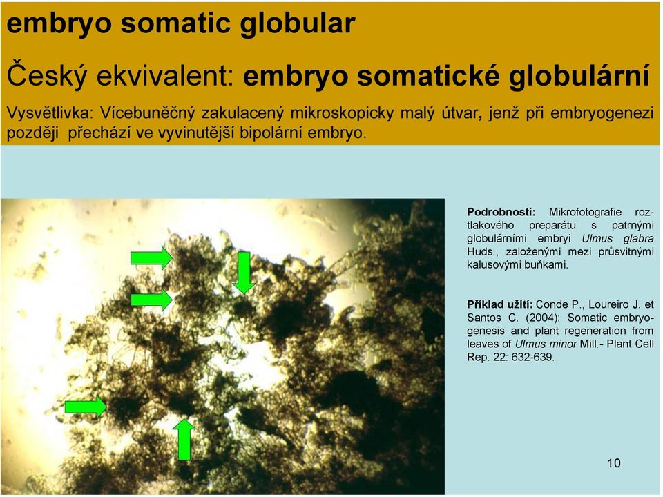 Podrobnosti: Mikrofotografie roztlakového preparátu s patrnými globulárními embryi Ulmus glabra Huds.