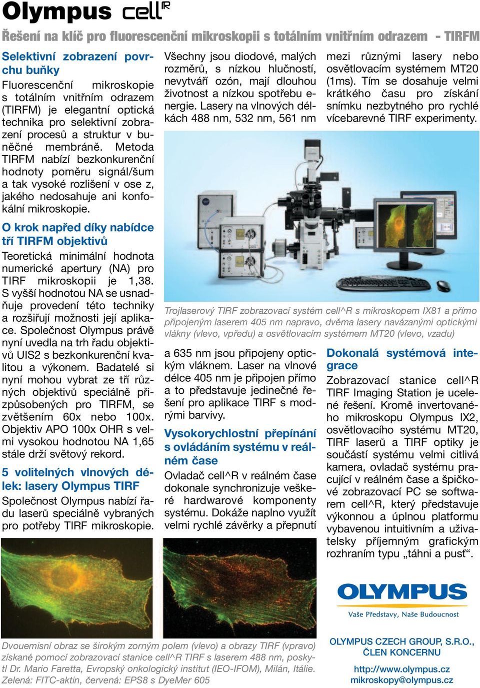 Metoda TIRFM nabízí bezkonkurenční hodnoty poměru signál/šum a tak vysoké rozlišení v ose z, jakého nedosahuje ani konfokální mikroskopie.