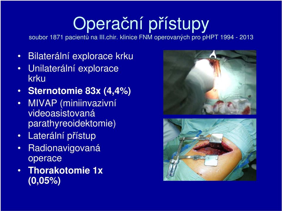 Unilaterální explorace krku Sternotomie 83x (4,4%) MIVAP (miniinvazivní