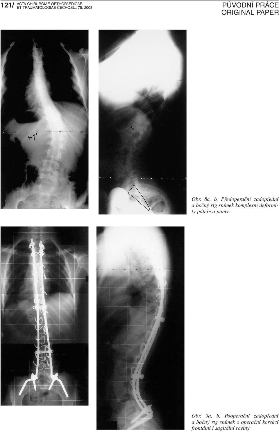 komplexní deformity páteře a pánve Obr. 9a, b.