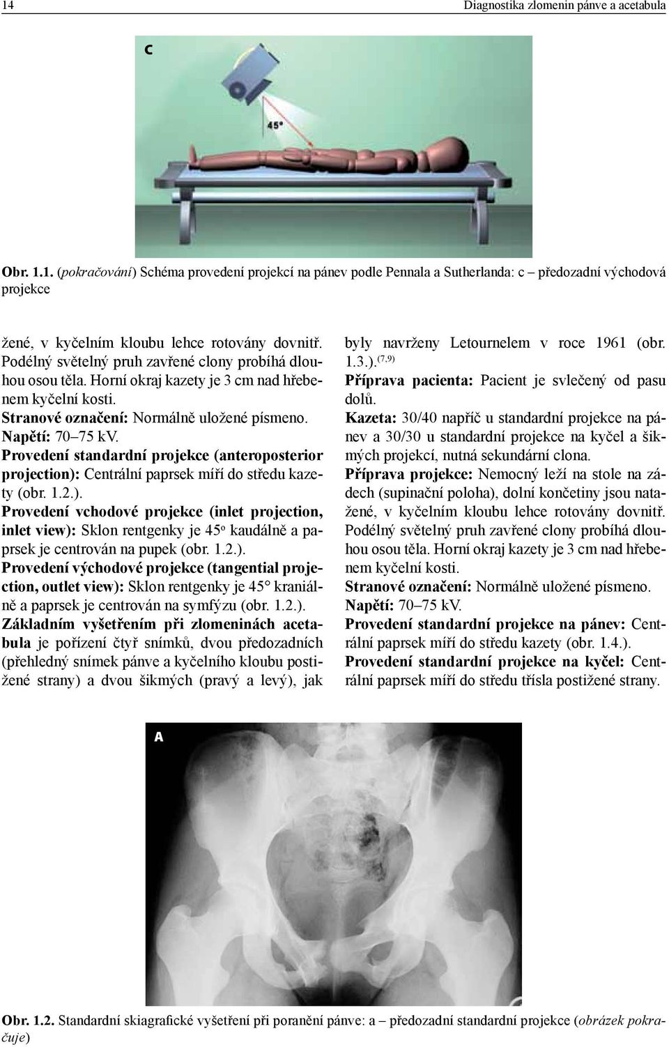 Provedení standardní projekce (anteroposterior projection): Centrální paprsek míří do středu kazety (obr. 1.2.). Provedení vchodové projekce (inlet projection, inlet view): Sklon rentgenky je 45 o kaudálně a paprsek je centrován na pupek (obr.