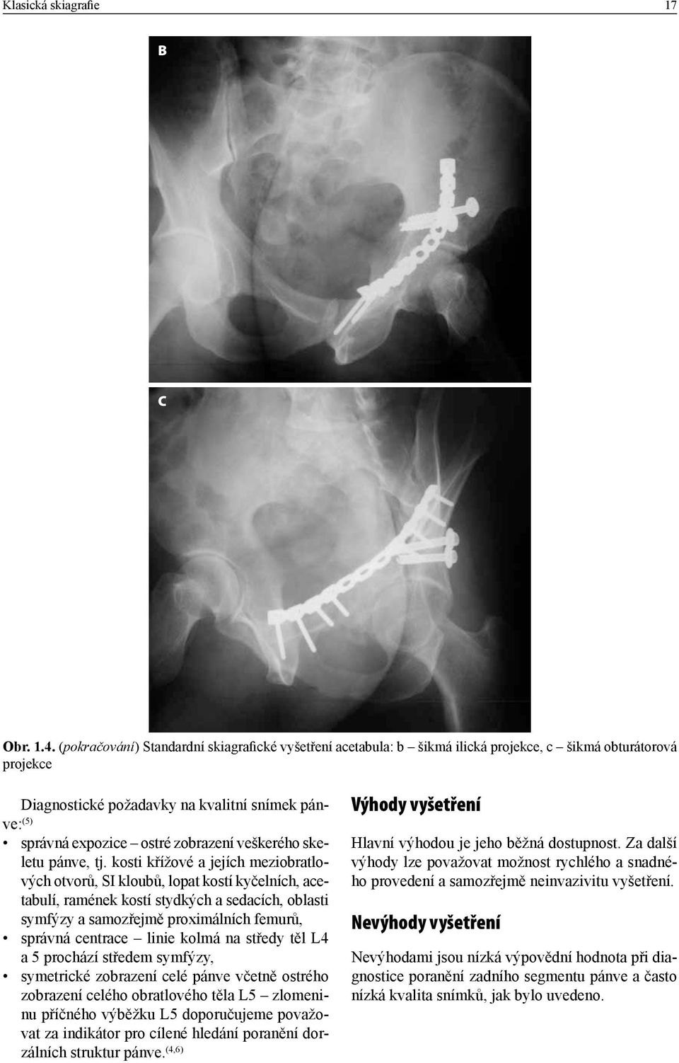 veškerého skeletu pánve, tj.