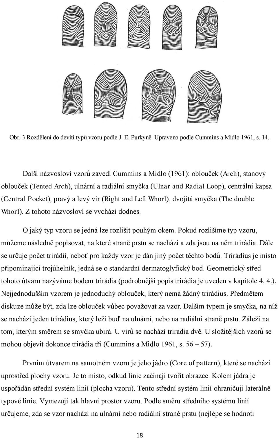 levý vír (Right and Left Whorl), dvojitá smyčka (The double Whorl). Z tohoto názvosloví se vychází dodnes. O jaký typ vzoru se jedná lze rozlišit pouhým okem.