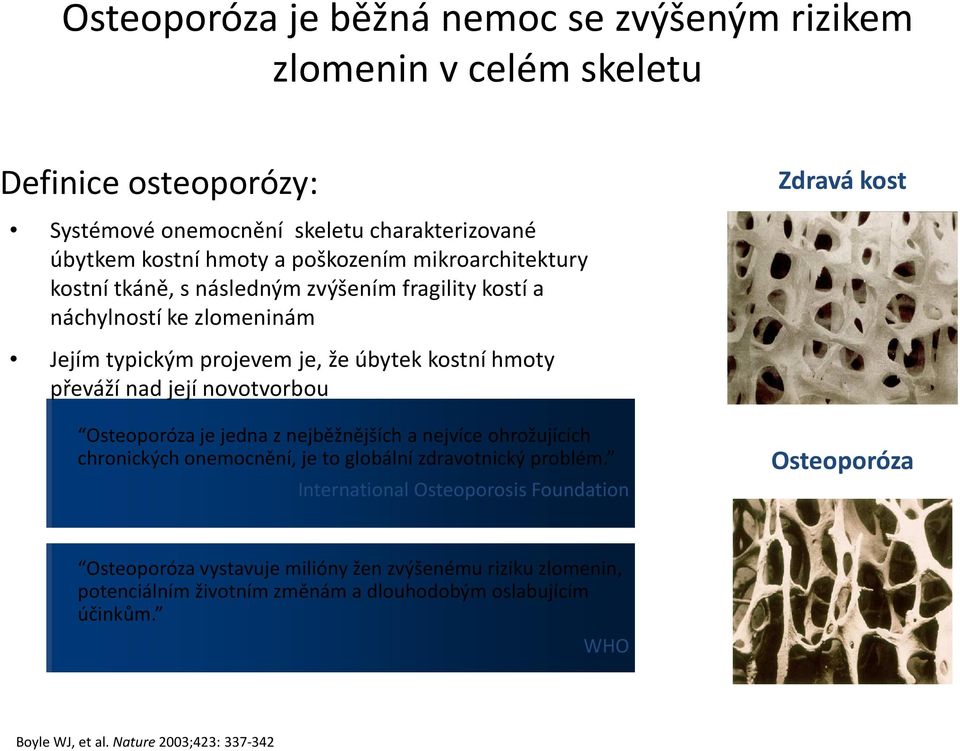 Osteoporóza je jedna znejběžnějších a nejvíce ohrožujících chronických onemocnění, je to globální zdravotnický problém.