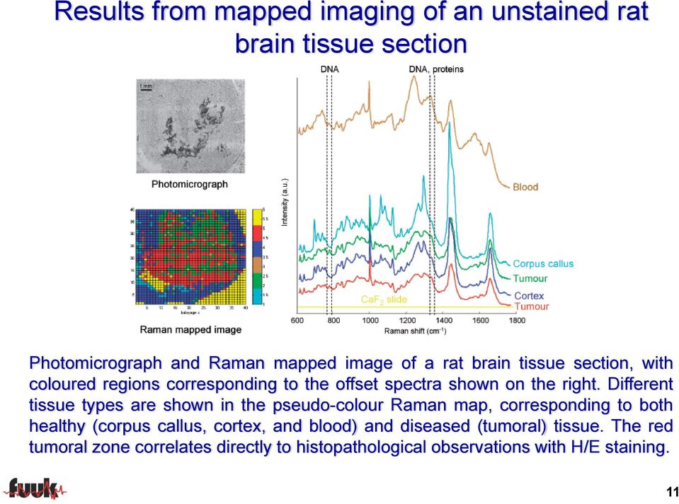 Different tissue types are shown in the pseudo-colour Raman map, corresponding to both healthy (corpus callus, cortex,