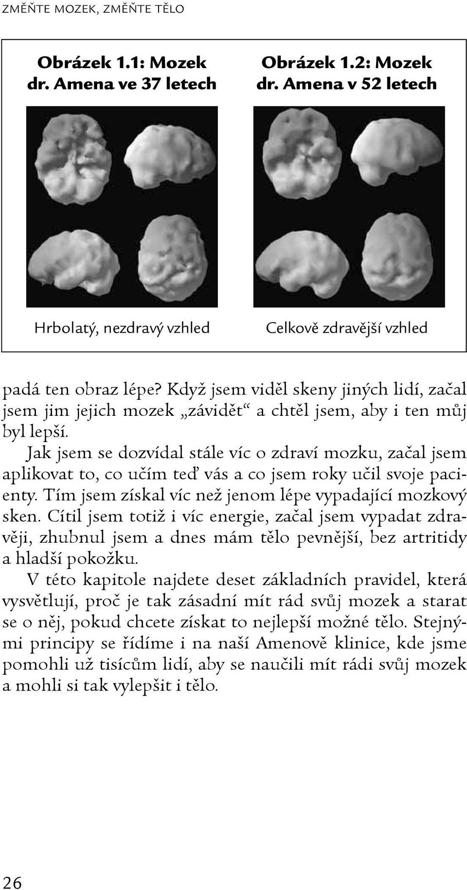 Jak jsem se dozvídal stále víc o zdraví mozku, začal jsem aplikovat to, co učím teď vás a co jsem roky učil svoje pacienty. Tím jsem získal víc než jenom lépe vypadající mozkový sken.