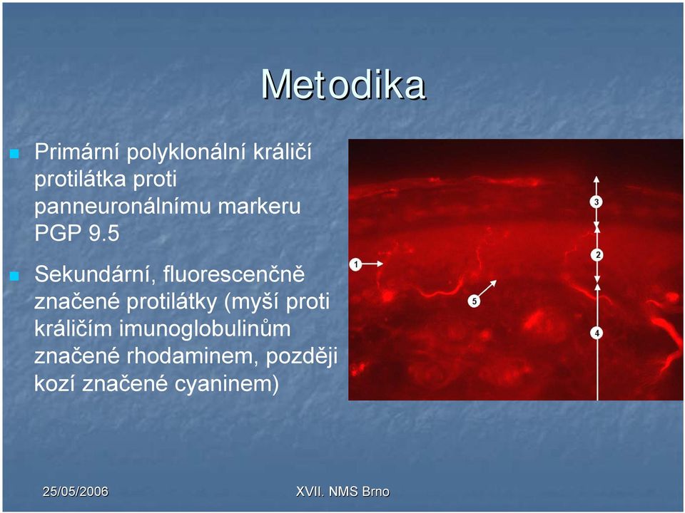 5 Sekundární, fluorescenčně značené protilátky (myší