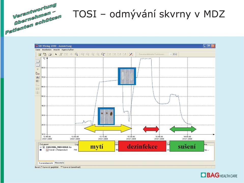 skvrny v