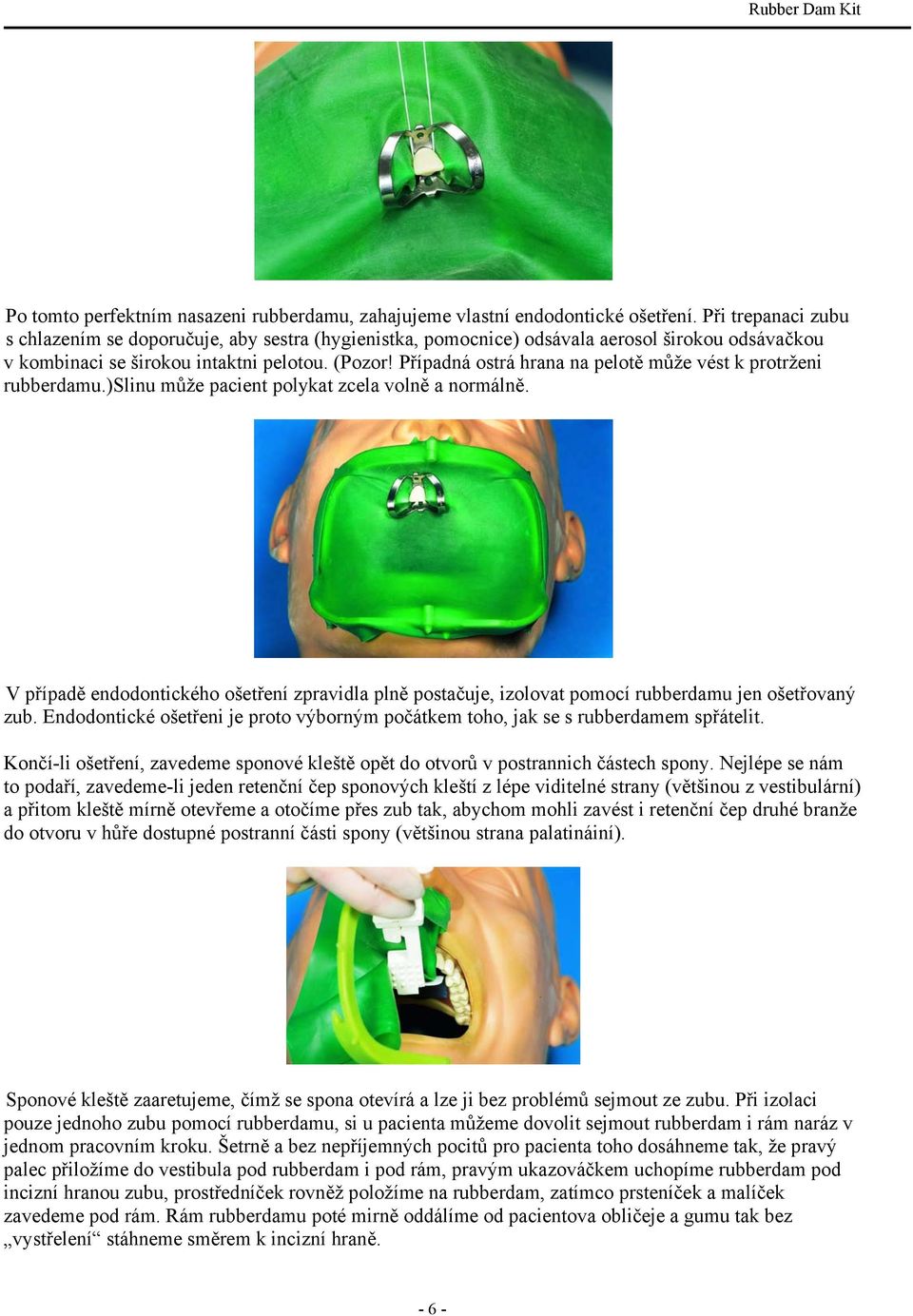 Případná ostrá hrana na pelotě může vést k protrženi rubberdamu.)slinu může pacient polykat zcela volně a normálně.