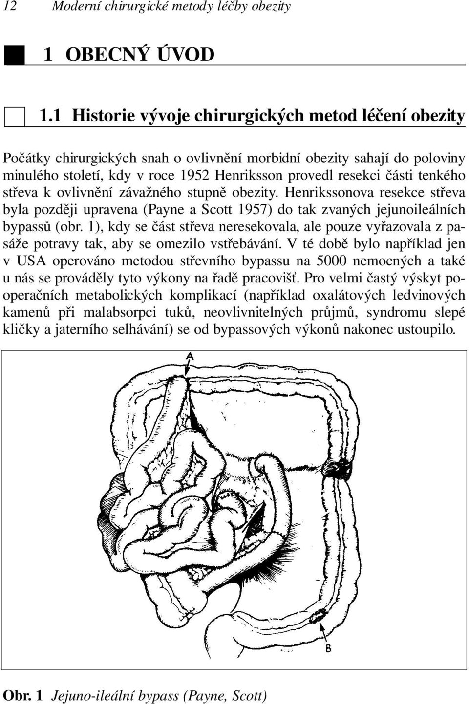 tenkého střeva k ovlivnění závažného stupně obezity. Henrikssonova resekce střeva byla později upravena (Payne a Scott 1957) do tak zvaných jejunoileálních bypassů (obr.
