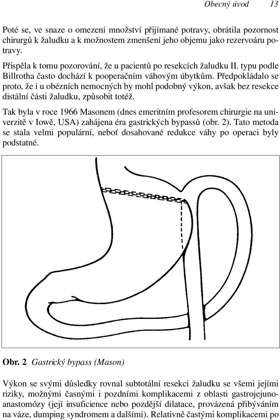 Předpokládalo se proto, že i u obézních nemocných by mohl podobný výkon, avšak bez resekce distální části žaludku, způsobit totéž.