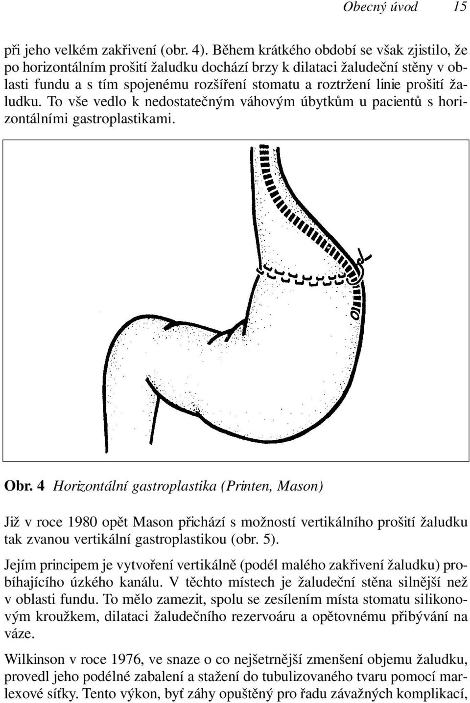 žaludku. To vše vedlo k nedostatečným váhovým úbytkům u pacientů s horizontálními gastroplastikami. Obr.