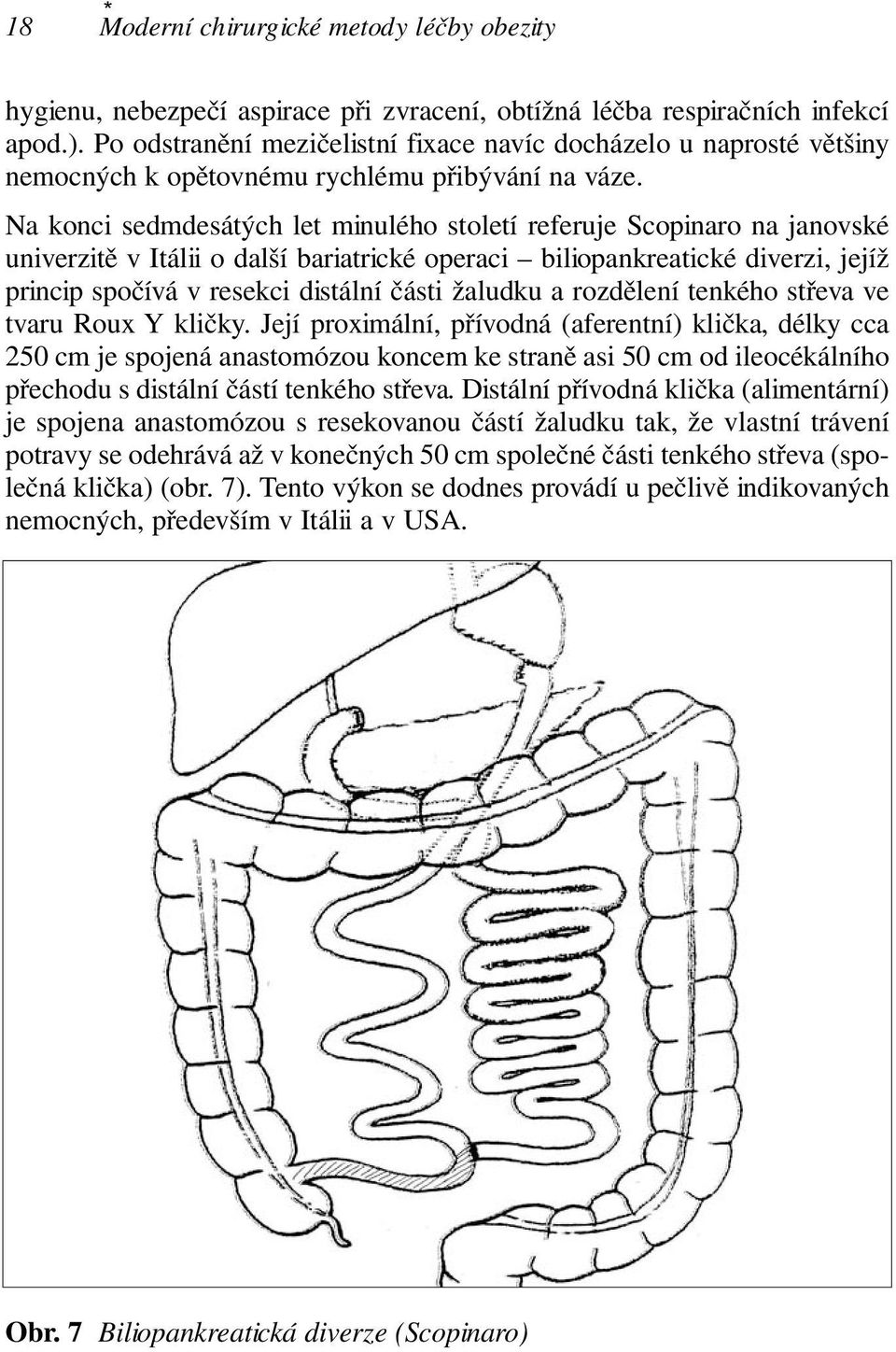 Na konci sedmdesátých let minulého století referuje Scopinaro na janovské univerzitě v Itálii o další bariatrické operaci biliopankreatické diverzi, jejíž princip spočívá v resekci distální části