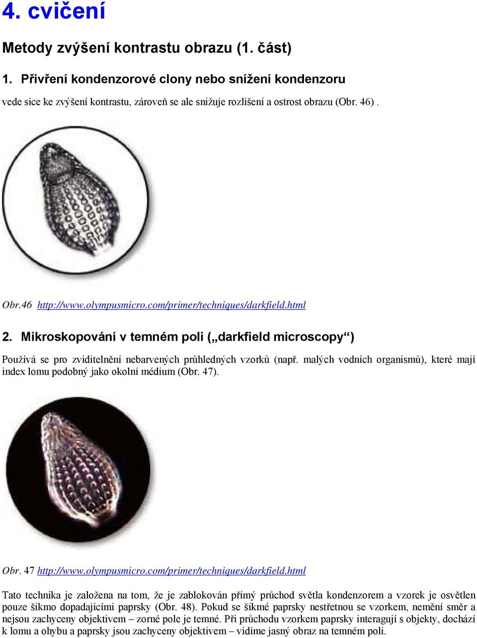 malých vodních organismů), které mají index lomu podobný jako okolní médium (Obr. 47). Obr. 47 http://www.olympusmicro.com/primer/techniques/darkfield.