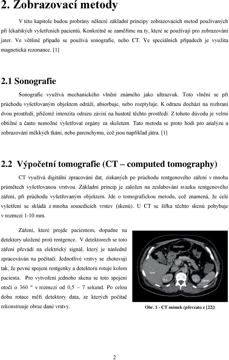 1 Sonografie Sonografie využívá mechanického vlnění známého jako ultrazvuk. Toto vlnění se při průchodu vyšetřovaným objektem odráží, absorbuje, nebo rozptyluje.
