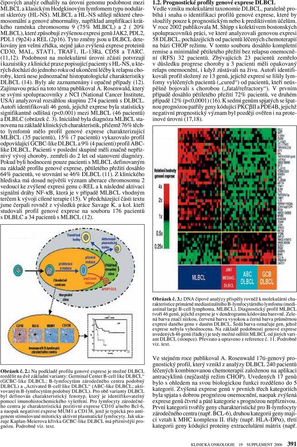 PDL1 (9p24) a REL (2p16). Tyto zmûny jsou u DLBCL detekovány jen velmi zfiídka, stejnû jako zv ená exprese proteinû CD30, MAL, STAT1, TRAF1, IL-13Rá, CD58 a TARC. (11,12).