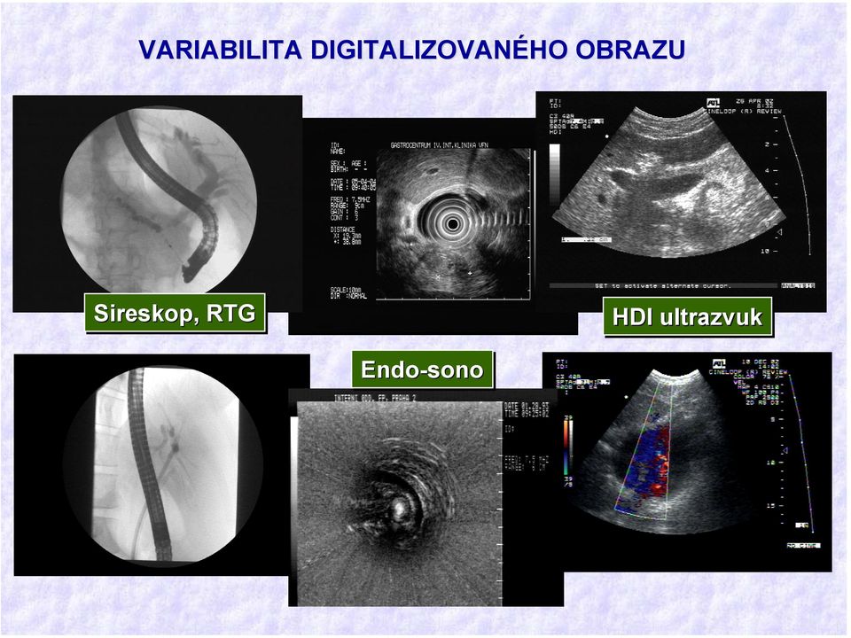 OBRAZU Sireskop, RTG