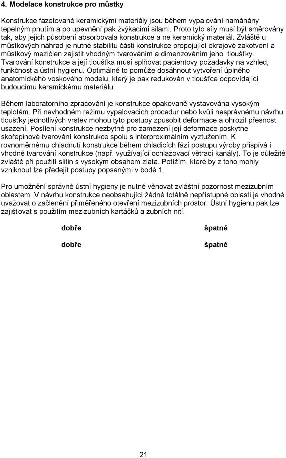 Zvláště u můstkových náhrad je nutné stabilitu části konstrukce propojující okrajové zakotvení a můstkový mezičlen zajistit vhodným tvarováním a dimenzováním jeho tloušťky.