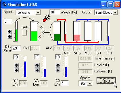 Literatura Baxter AD.: Low and minimal flow inhalational anaesthesia. Can J Anaesth 1997;44:643-52.