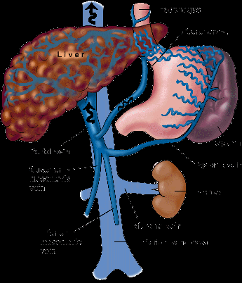 MELD skóre (Model of Liver Disease): 3 měsíční mortalita 9,57 * ln(kreatinin/88,5) + 3,78 * ln(bilirubin/17,1) + 11,20