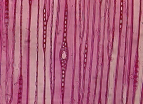 3.1.2 Mikroskopická stavba Mezi mikroskopické znaky smrku patří: a) přítomnost pryskyřičných kanálků, b) tlustostěnné epitelové buňky pryskyřičných kanálků, c) heterocelulární typ dřeňového paprsku,