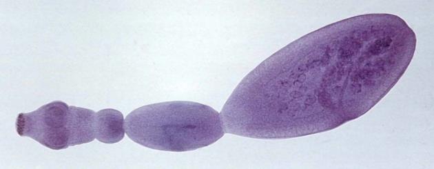 larvocysta (boubel) cysticercus (1), coenurus (10), echinococcus (400000 ex.