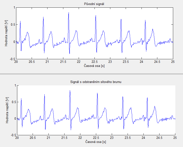 síťového brumu v oblasti frekvenční, kde jsou rozdíly dobře patrné i pro nízkou úroveň rušení, viz kapitola 7.4.1. Při filtraci dochází k zpoždění signálu o vzorku, kde je řád filtru.