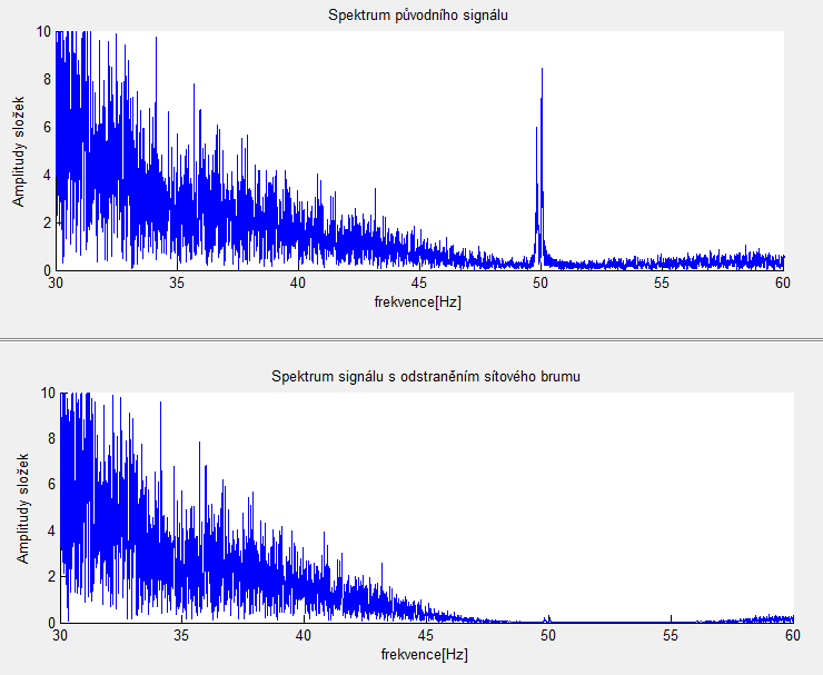 Obr. 19: Porovnání signálu před a po odstranění síťového brumu ve frekvenční oblasti s přiblížením na oblast filtrace, 50 Hz 7.3.2.