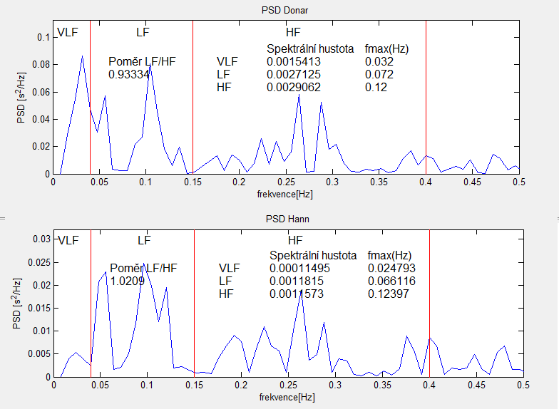 Obr. 25: Porovnání metod, PSD Donar a PSD Hann, výpočtu výkonového spektra Ob Obr Obr.