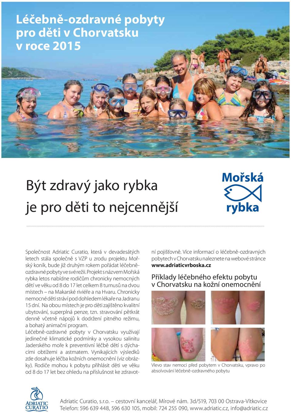 Projekt s názvem Mořská rybka letos nabídne rodičům chronicky nemocných dětí ve věku od 8 do 17 let celkem 8 turnusů na dvou místech na Makarské riviéře a na Hvaru.