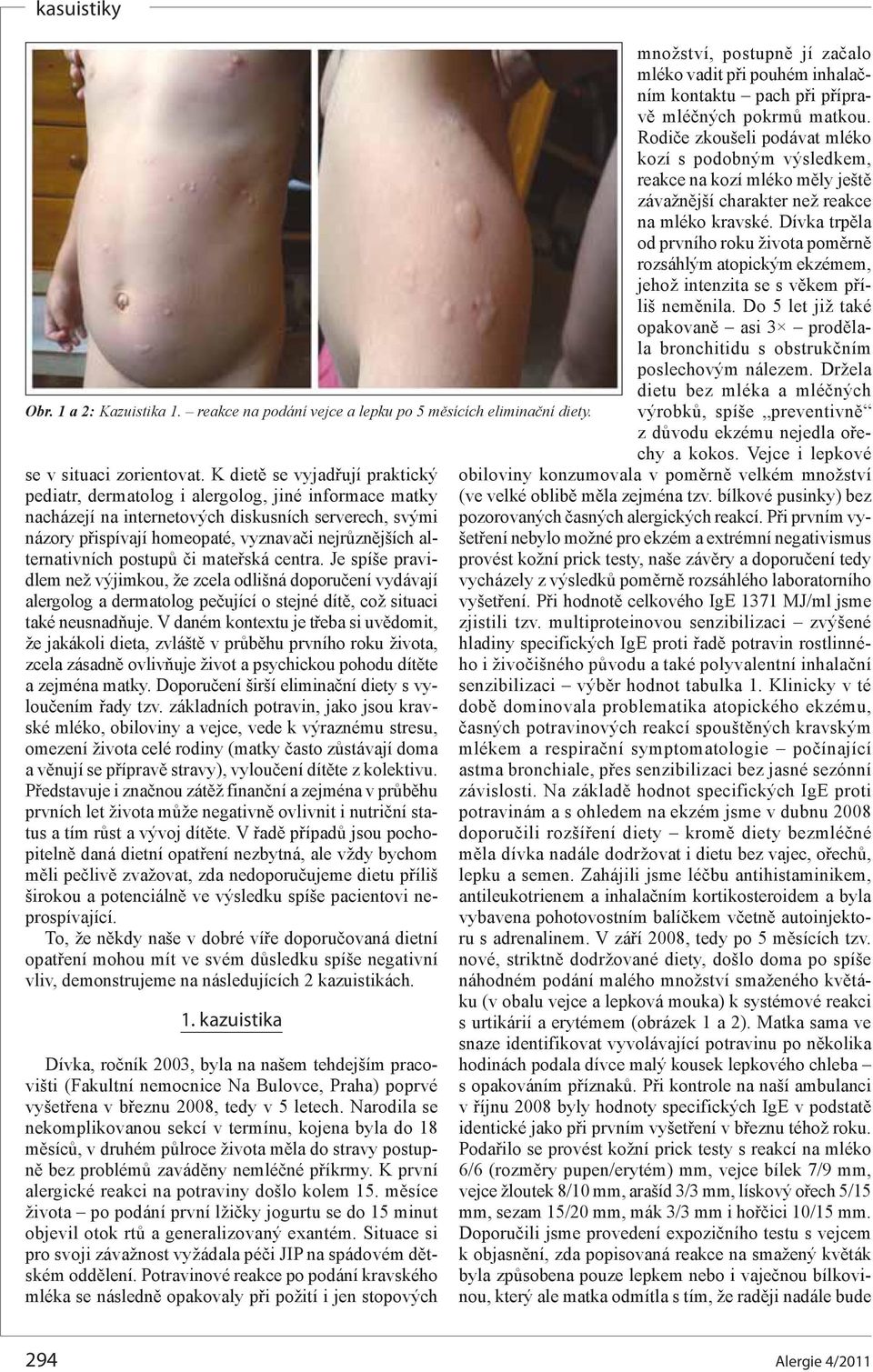 alternativních postupů či mateřská centra. Je spíše pravidlem než výjimkou, že zcela odlišná doporučení vydávají alergolog a dermatolog pečující o stejné dítě, což situaci také neusnadňuje.