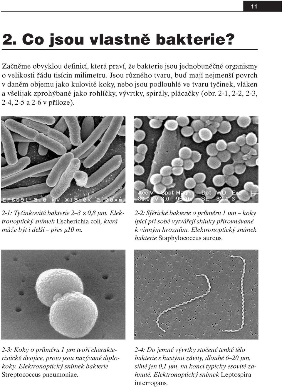 2-1, 2-2, 2-3, 2-4, 2-5 a 2-6 v pfiíloze). 2-1: Tyãinkovitá bakterie 2 3 0,8 µm. Elektronoptick snímek Escherichia coli, která mûïe b t i del í pfies µ10 m.