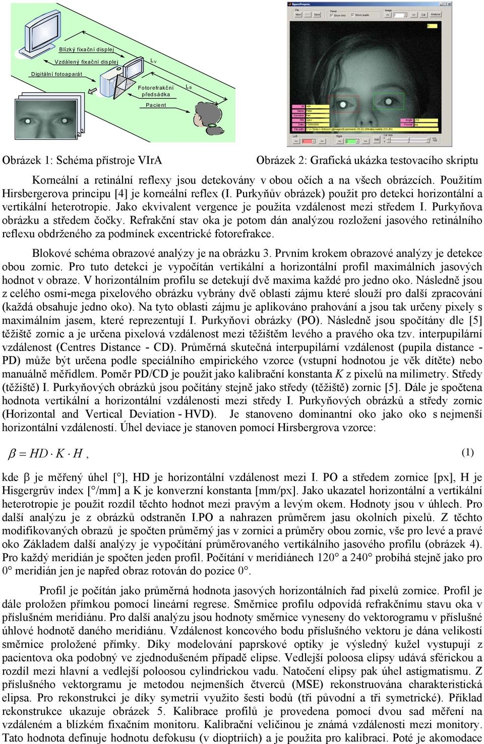 Purkyňův obrázek) použit pro detekci horizontální a vertikální heterotropie. Jako ekvivalent vergence je použita vzdálenost mezi středem I. Purkyňova obrázku a středem čočky.