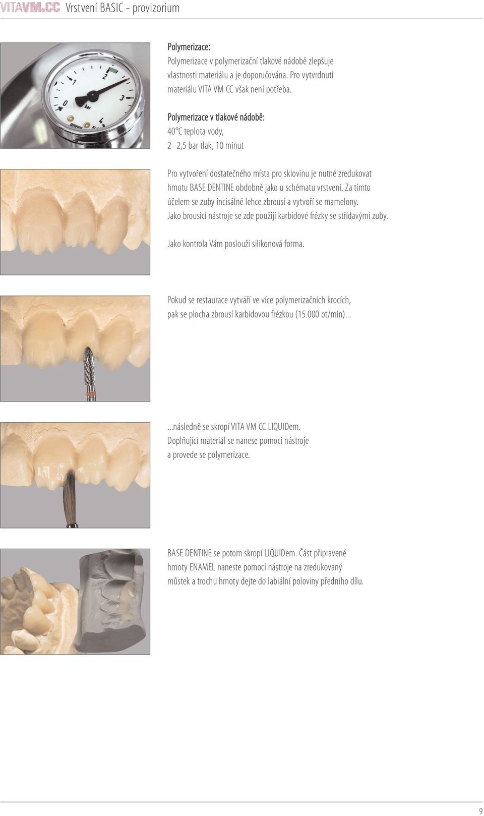 Za tímto účelem se zuby incisálně lehce zbrousí a vytvoří se mamelony. Jako brousicí nástroje se zde použijí karbidové frézky se střídavými zuby. Jako kontrola Vám poslouží silikonová forma.