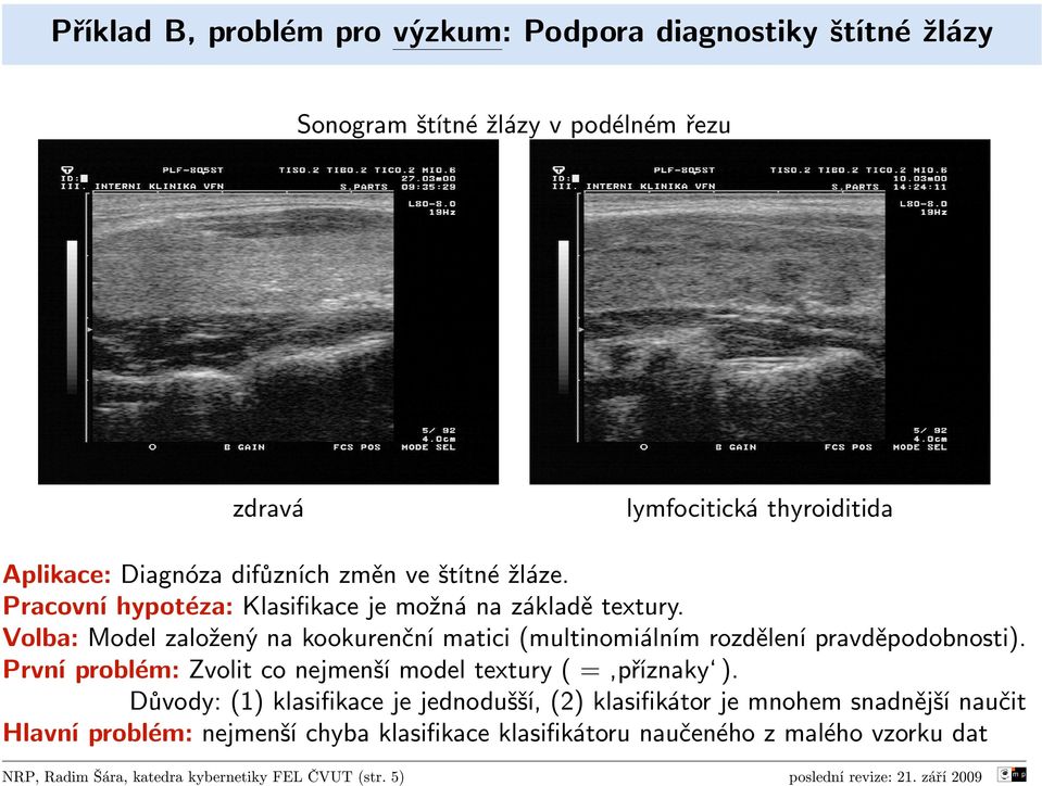 Volba: Model založený na kookurenční matici (multinomiálním rozdělení pravděpodobnosti). První problém: Zvolit co nejmenší model textury ( = příznaky ).