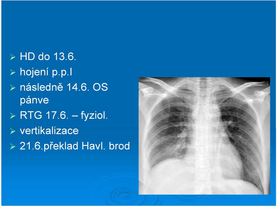 OS pánve RTG 17.6. fyziol.