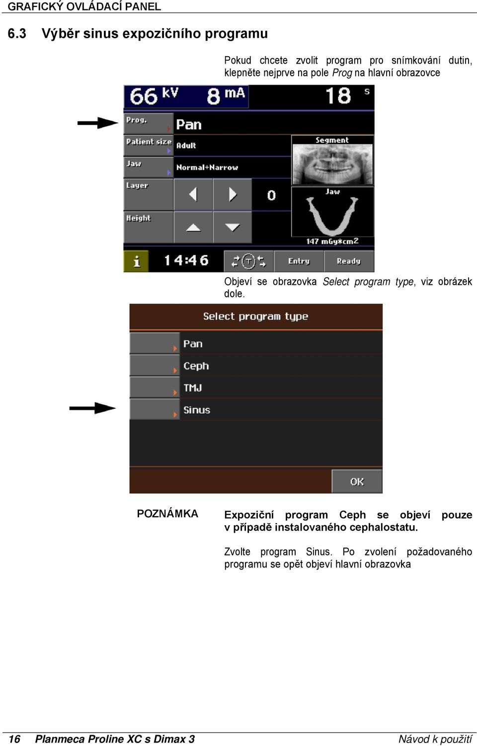 pole Prog na hlavní obrazovce Objeví se obrazovka Select program type, viz obrázek dole.