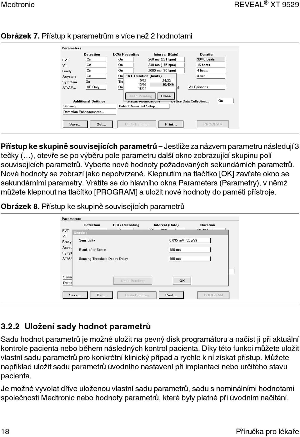 skupinu polí souvisejících parametrů. Vyberte nové hodnoty požadovaných sekundárních parametrů. Nové hodnoty se zobrazí jako nepotvrzené.