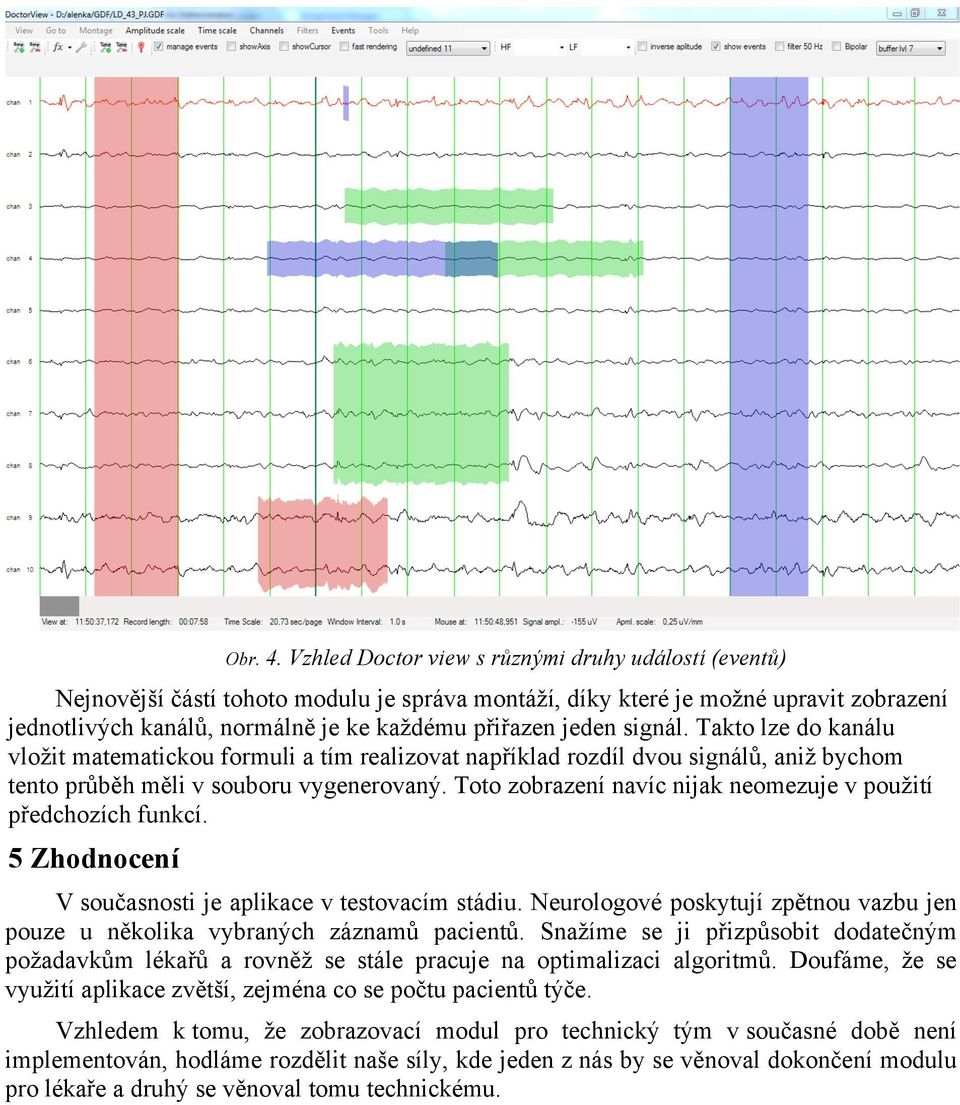 signál. Takto lze do kanálu vložit matematickou formuli a tím realizovat například rozdíl dvou signálů, aniž bychom tento průběh měli v souboru vygenerovaný.