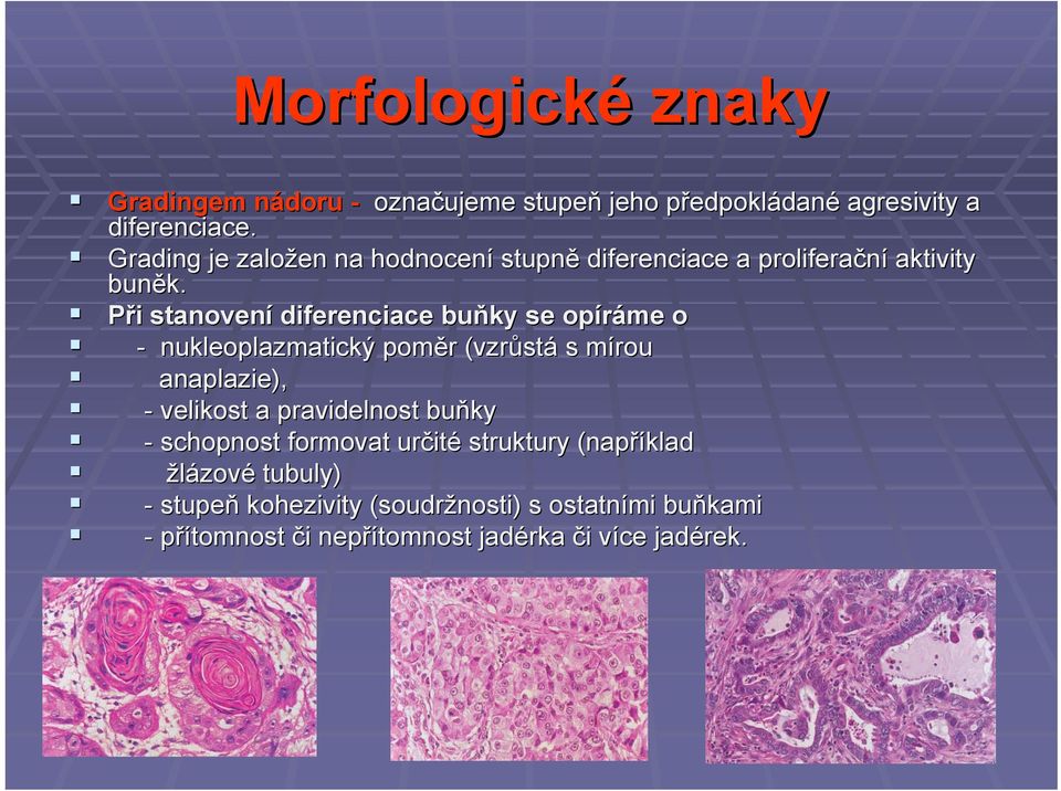 Při i stanovení diferenciace buňky se opíráme o - nukleoplazmatický poměr r (vzrůst stá s mírou m anaplazie), - velikost a