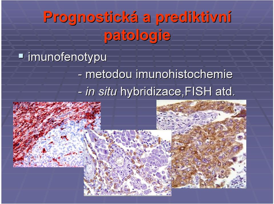 metodou imunohistochemie -